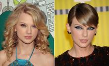 Taylor Swift Plastic Surgery