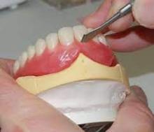 Partial Dentures St Augustine