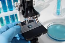 Raman Spectrometer in India