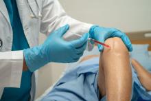 Stem Cell Therapy for Knee