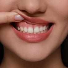 Emergency & Cosmetic Dentist in Mississauga | Milestone Dentistry