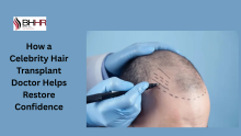  celebrity hair transplant doctor