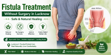 Fistula Treatment Without Surgery in Lucknow