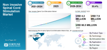Non invasive Spinal Cord Stimulation, Non invasive Spinal Cord Stimulation Industry, Non invasive Spinal Cord Stimulation Market, Non invasive Spinal Cord Stimulation Market Size, Non invasive Spinal Cord Stimulation Market Share, Non invasive Spinal Cord Stimulation Market Trends, Non invasive Spinal Cord Stimulation Market Growth, Non invasive Spinal Cord Stimulation Market Demand