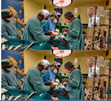AV Fistula Symptoms