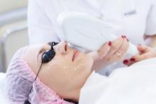 laser facial Delhi