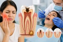 Root Canal Treatment in Gurgaon | Dr. Gupta's Shri Ram Dental Care