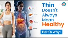  sarcopenic obesity