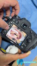 Traitement orthodontique