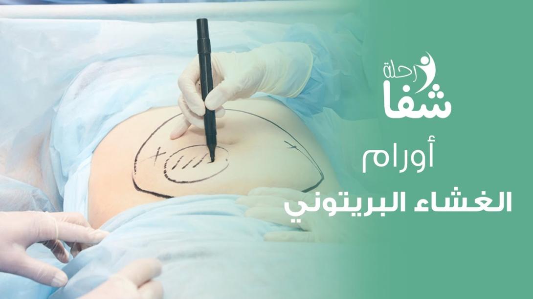 liposuction