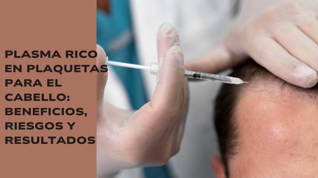 plasma rico en plaquetas para el cabello