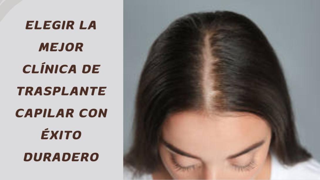 clinica de trasplante capilar