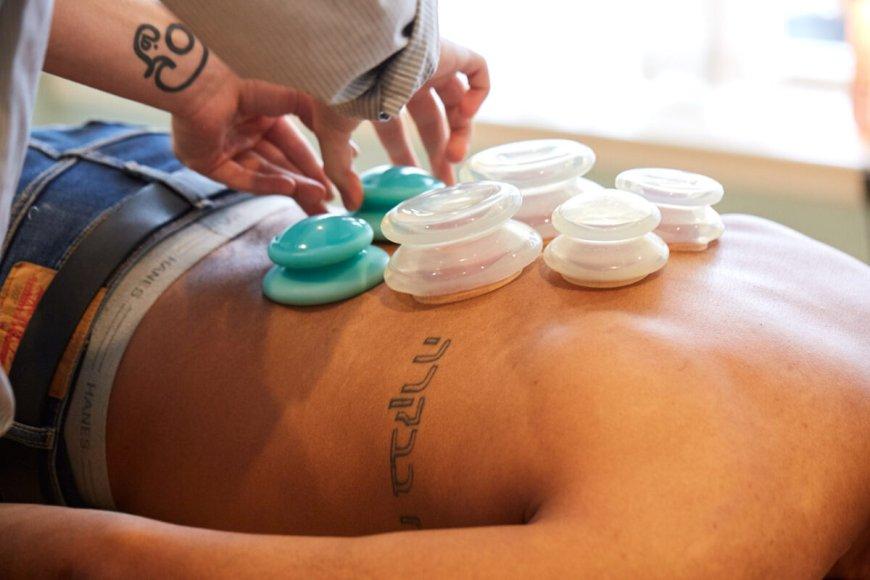 Cupping Therapy in Philadelphia