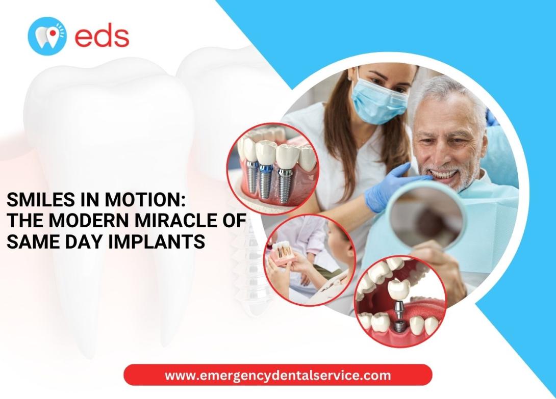 Same Day Dental Implants
