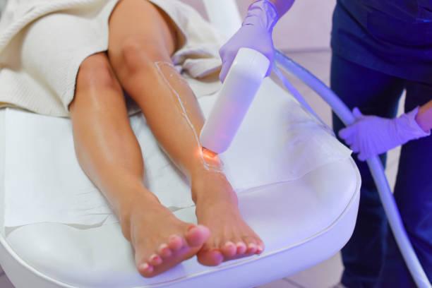 Laser Hair Removal in Dubai