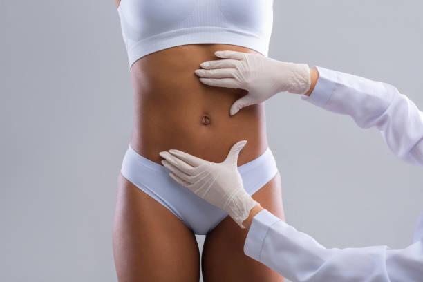 Liposuction in Dubai