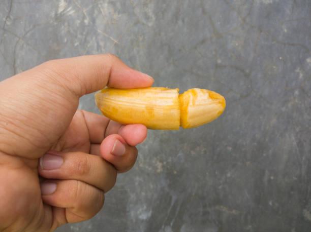 Penile enlargement in Dubai