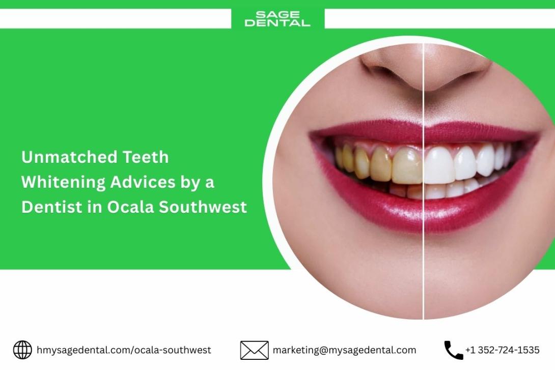 Unmatched Teeth Whitening Advices by a Dentist in Ocala Southwest