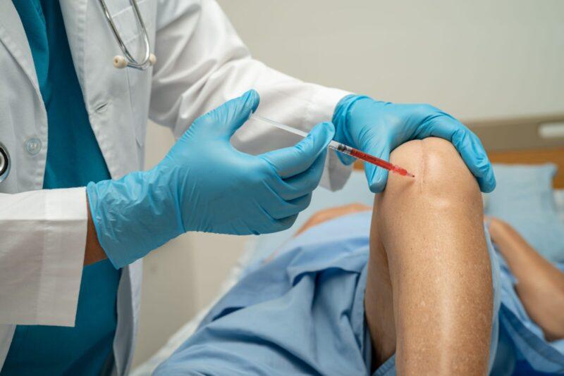 Stem Cell Therapy for Knee