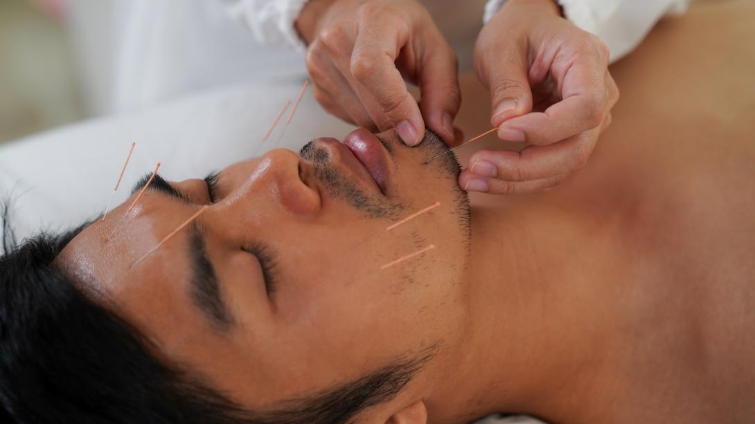 Facial acupuncture in Philadelphia