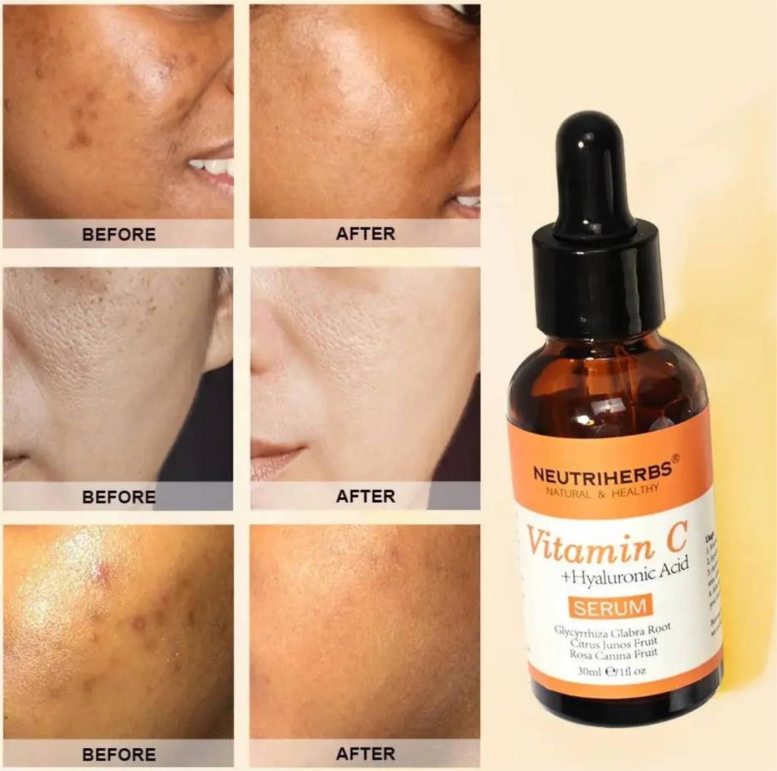 Vitamin C Serum Before and After 