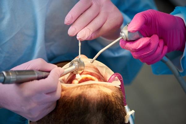 patient undergoing root canal treatment