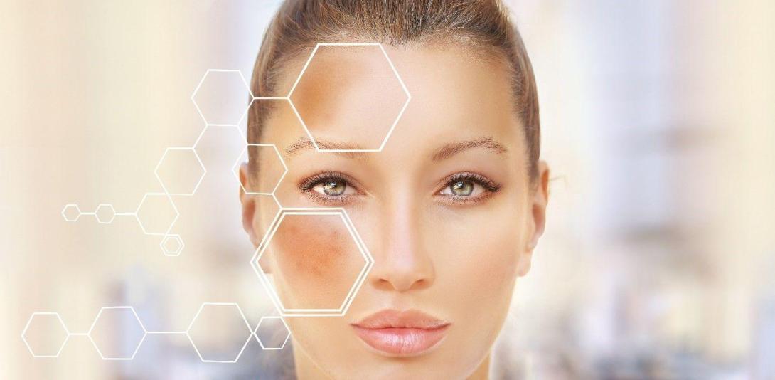 Pigmentation Treatment in Ghaziabad