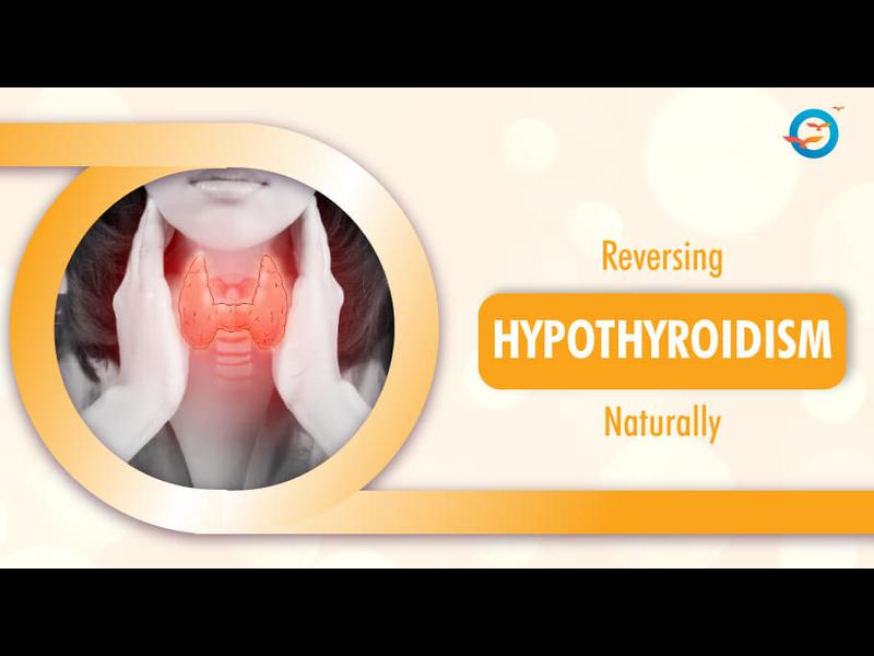 hypothyroidism natural treatment