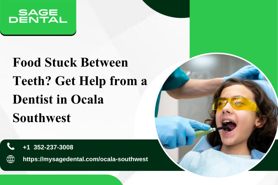 Food Stuck Between Teeth? Get Help from a Dentist in Ocala Southwest