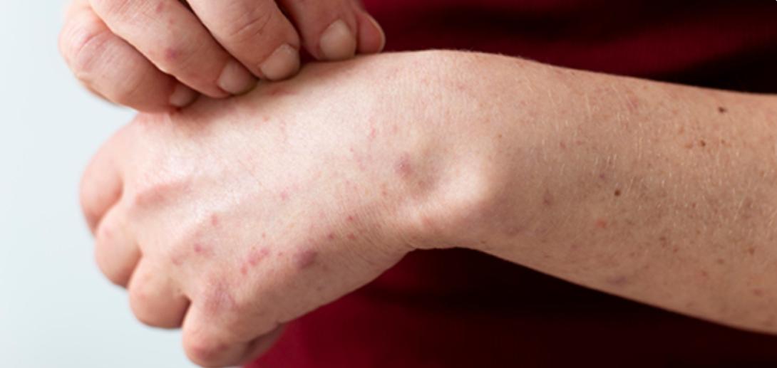 tiny dots on skin
