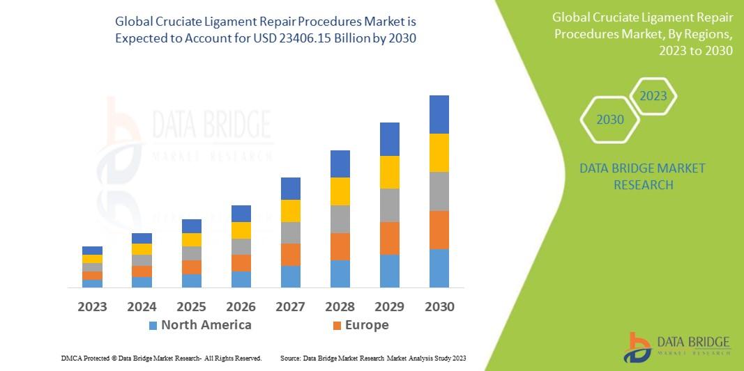 Data Bridge Market Research analyses that the cruciate ligament repair procedures market which is USD 12186.87 billion in 2022, is expected to reach USD 23406.15 billion by 2030, at a CAGR of 8.5% during the forecast period 2023 to 2030