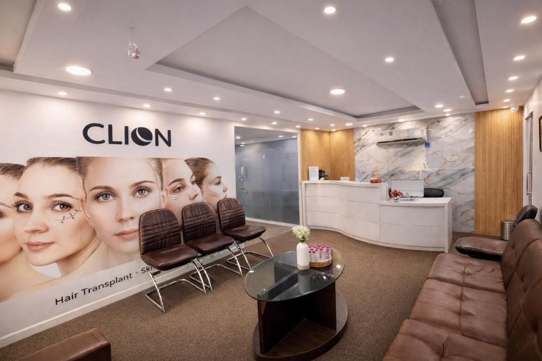 hair transplant cost in ahmedabad