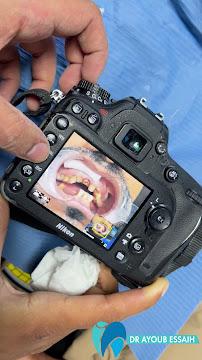 Traitement orthodontique
